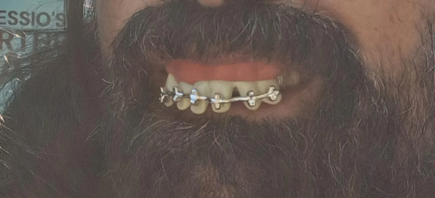 P'tit Clown Dentiera Finta denti finti adulto taglia unica